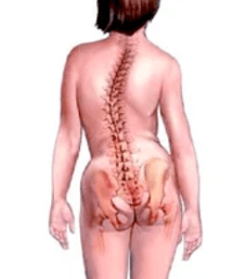 Patologia sistemului musculo -scheletic