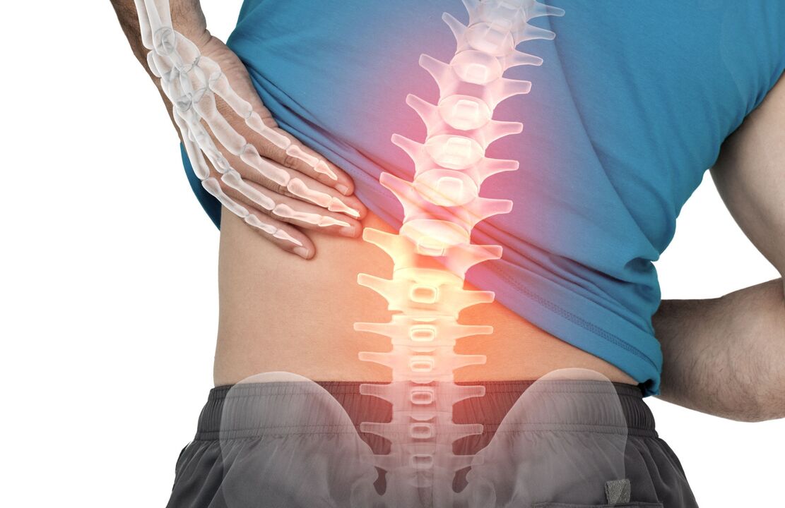 Pericolul ostecondrozei lombare