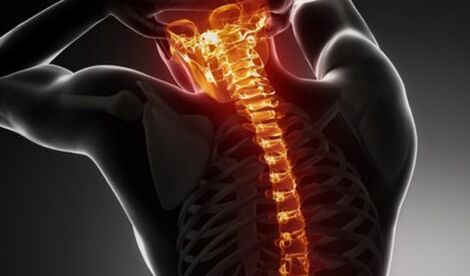Osteochondroza întregii coloană vertebrală