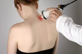 Tratamentul osteochondrozei cervicale cu terapie cu laser