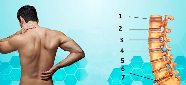 stadiile dezvoltării osteocondrozei