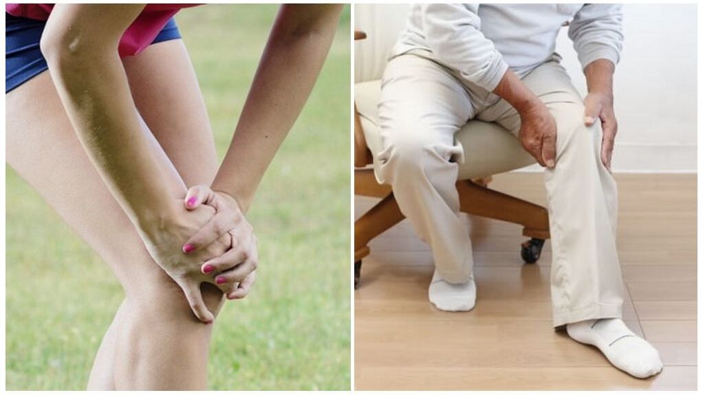 Leziunile și modificările legate de vârstă sunt principalele cauze ale artrozei articulației genunchiului